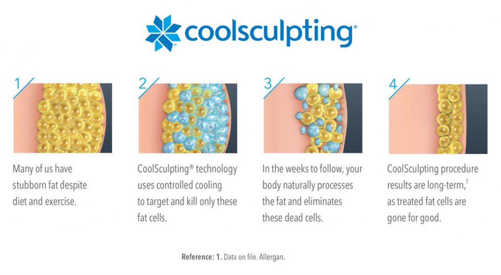 Coolsculpting Near Me Coolsculpting Coolsculpting before and after