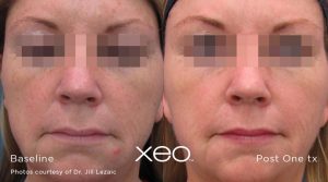 Xeo Pigment