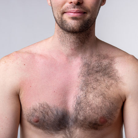 Man hairy chest