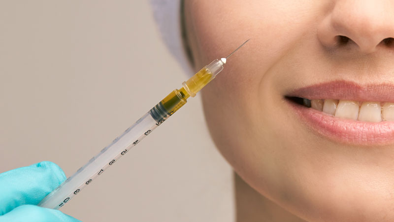 PRP facial injection treatment